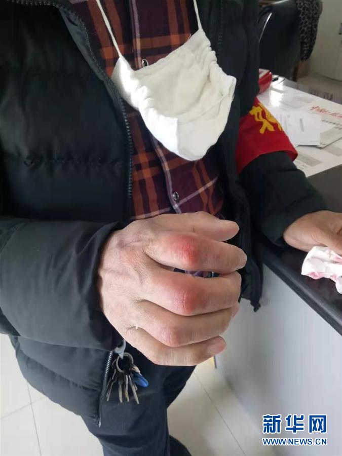 (在習近平新時代中國特色社會主義思想指引下——新時代新作為新篇章·習近平總書記關切事·圖文互動)(2)戰(zhàn)“疫”中的“凡人微光”